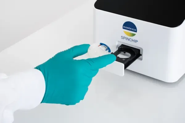 Illustration - test de troponine SPINCHIP